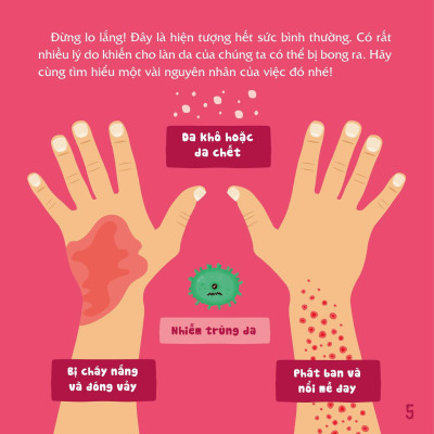 Có Thể Bạn Chưa Biết- Vì Sao Chúng Ta... Bị Bong Da?