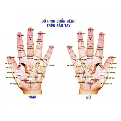 Dụng Cụ day ấn Huyệt Mát xa Chữ nhật Gỗ Bách Xanh (MH855) Cổ, vai, tay, bụng, eo, chân, kiểu thái - Chăm sóc sức khỏe